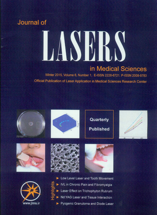 Journal of Lasers in Medical Sciences